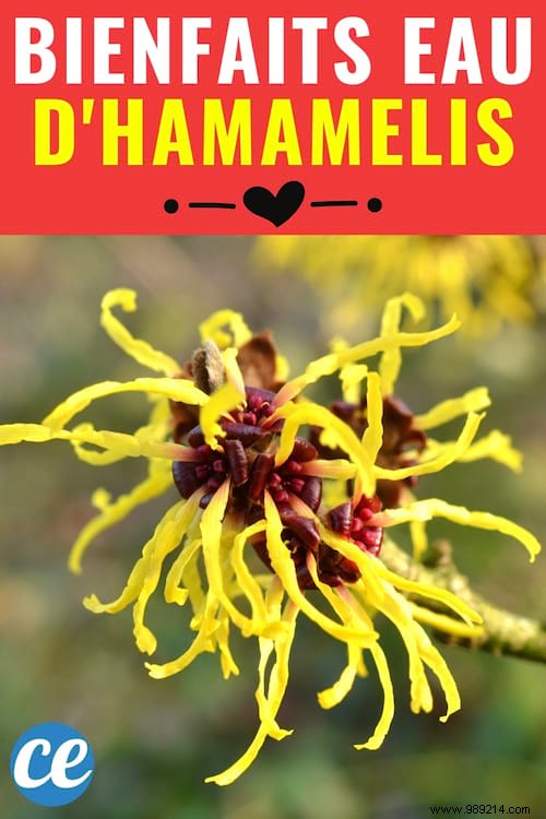 17 Proven Benefits of Witch Hazel Water for Skin, Hair, Circulation, and Wellness