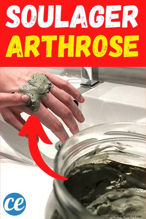 Clay Poultice: A Proven Natural Remedy for Fast Hand Osteoarthritis Pain Relief