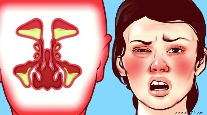 6 Proven Natural Techniques to Clear a Stuffy Nose Instantly