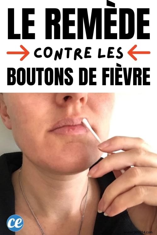 Grandma s Time-Tested Remedy: Quickly Dry Up Cold Sores on Lips with 70% Alcohol