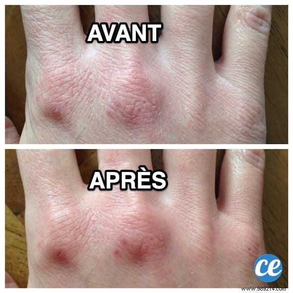 Heal Dry, Damaged Hands from Frequent Washing: Grandma s Proven Jojoba Oil Remedy