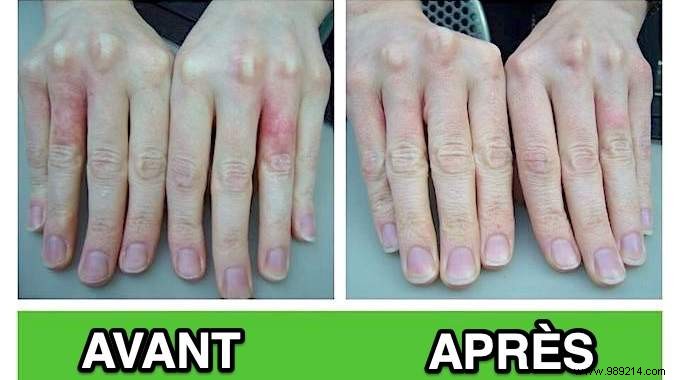 Heal Dry, Damaged Hands from Frequent Washing: Grandma s Proven Jojoba Oil Remedy