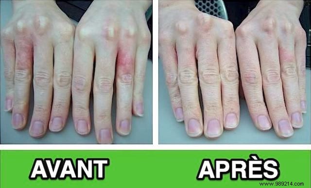 Heal Dry, Damaged Hands from Frequent Washing: Grandma s Proven Jojoba Oil Remedy