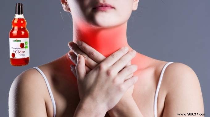 4 Time-Tested Apple Cider Vinegar Remedies for Sore Throat Relief