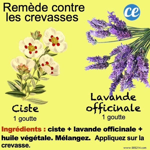 Heal Cracked Hands Naturally: Time-Tested Grandmother s Essential Oil Remedy