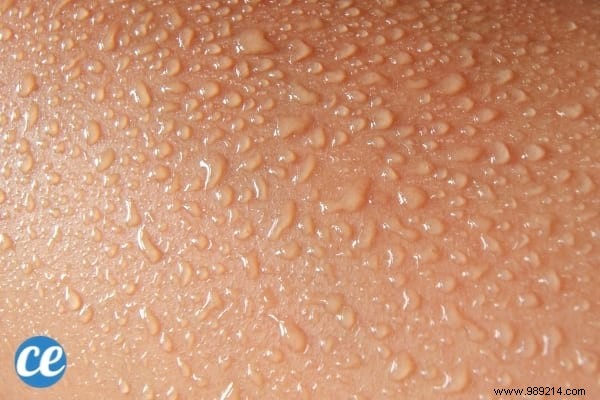 8 Proven Home Remedies to Relieve and Prevent Heat Rash Effectively