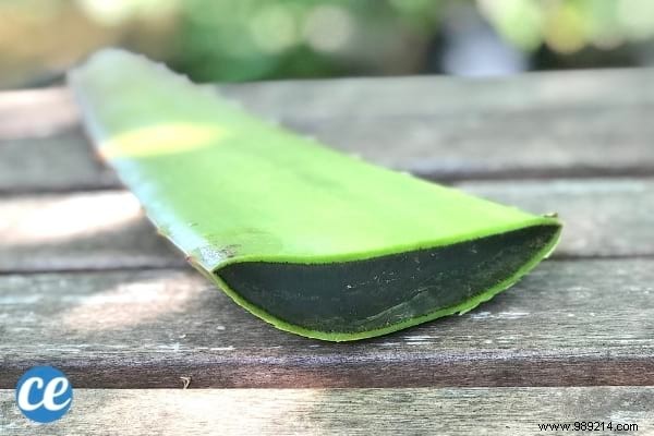 8 Proven Home Remedies to Relieve and Prevent Heat Rash Effectively