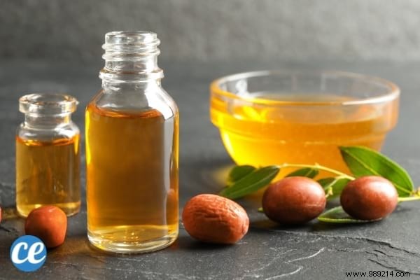 8 Proven Home Remedies to Relieve and Prevent Heat Rash Effectively