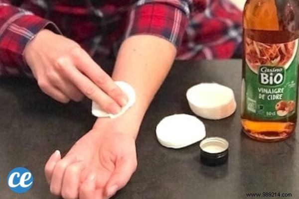 8 Proven Home Remedies to Relieve and Prevent Heat Rash Effectively