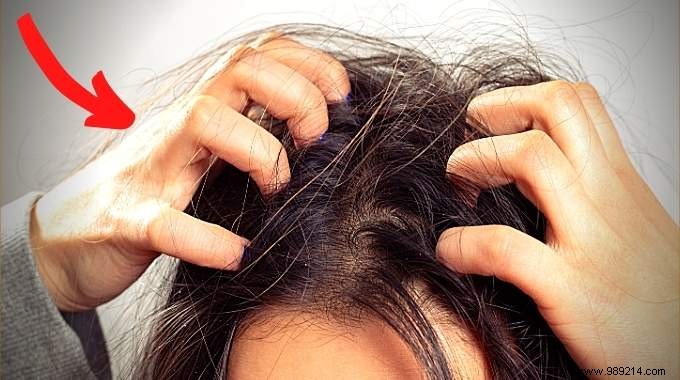 4 Proven Natural Remedies for Itchy Scalp Relief