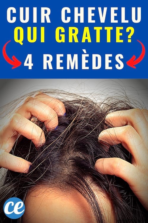 4 Proven Natural Remedies for Itchy Scalp Relief
