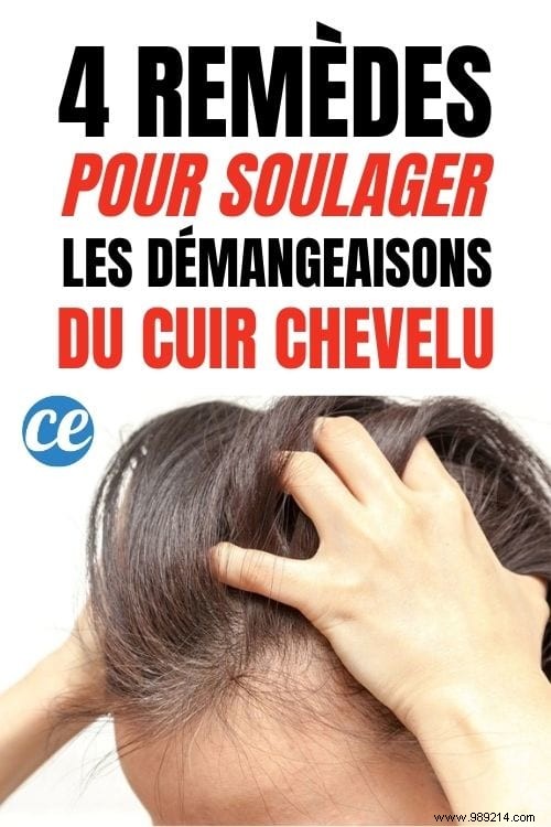 4 Proven Natural Remedies for Itchy Scalp Relief