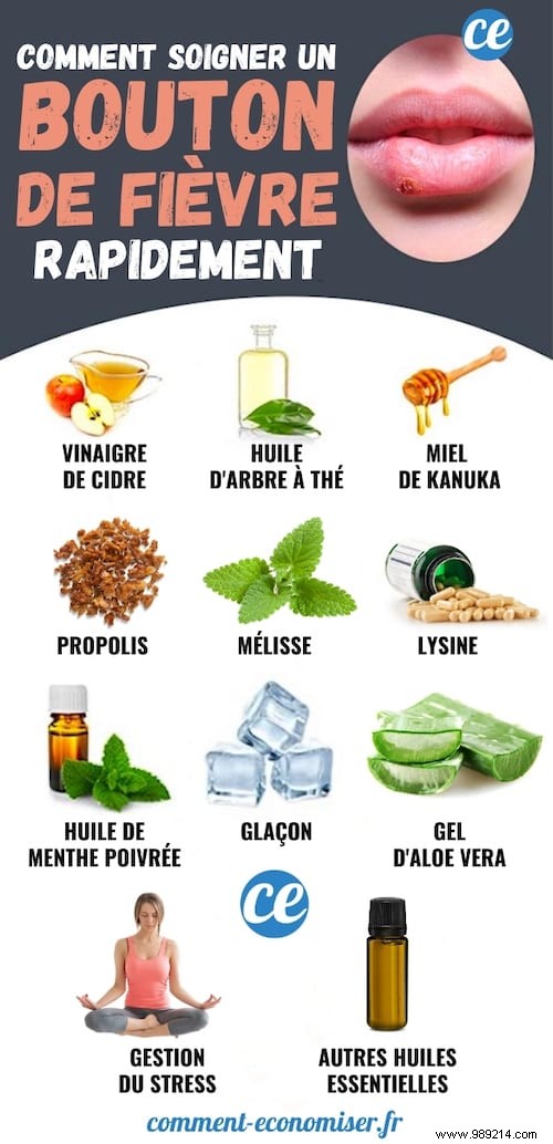 11 Science-Backed Home Remedies to Heal Cold Sores Fast