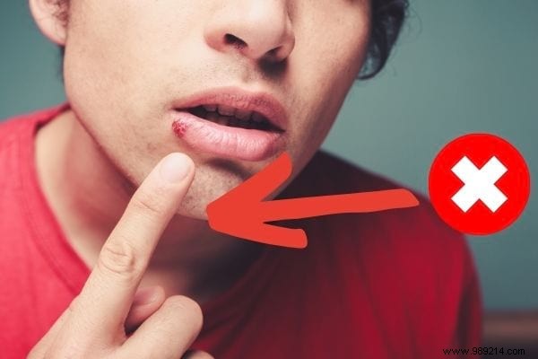 11 Science-Backed Home Remedies to Heal Cold Sores Fast