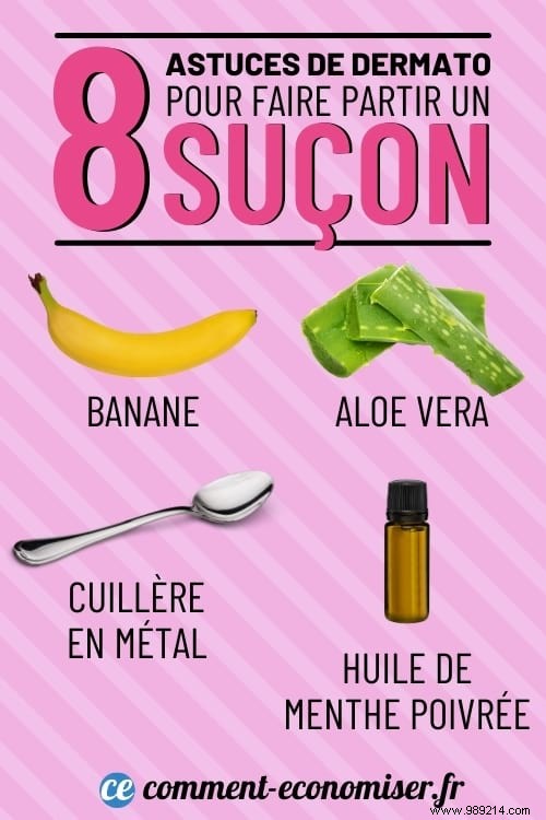 8 Dermatologist-Recommended Remedies to Fade a Hickey Faster