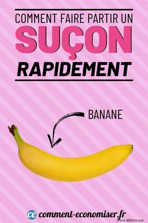 8 Dermatologist-Recommended Remedies to Fade a Hickey Faster