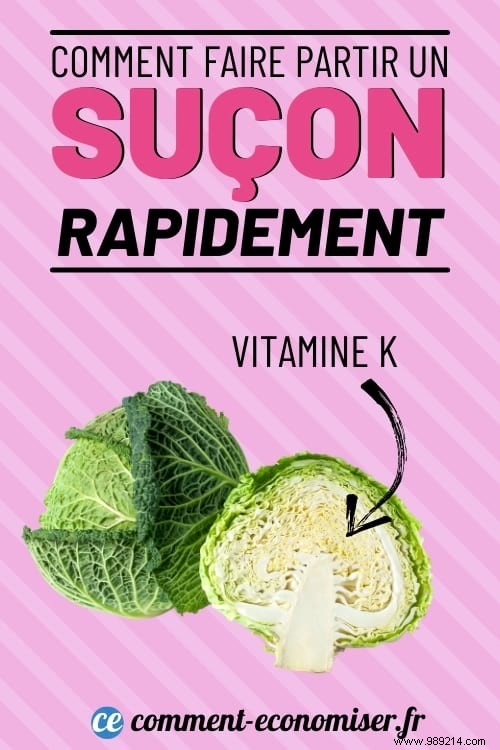 8 Dermatologist-Recommended Remedies to Fade a Hickey Faster