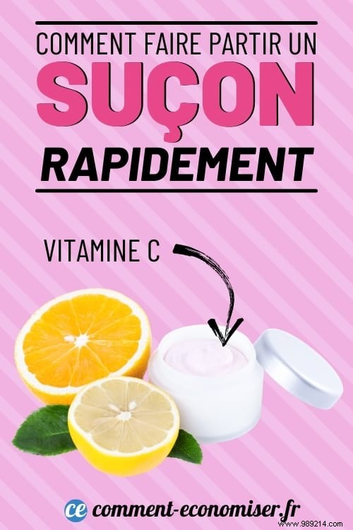 8 Dermatologist-Recommended Remedies to Fade a Hickey Faster