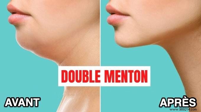 6 Proven Facial Exercises to Eliminate Your Double Chin – Expert-Backed Tips