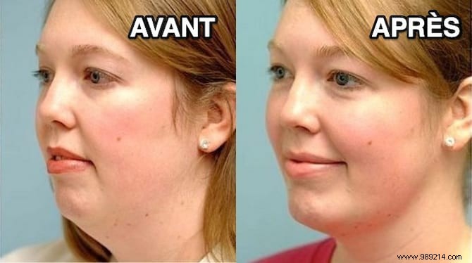 6 Proven Facial Exercises to Eliminate Your Double Chin – Expert-Backed Tips