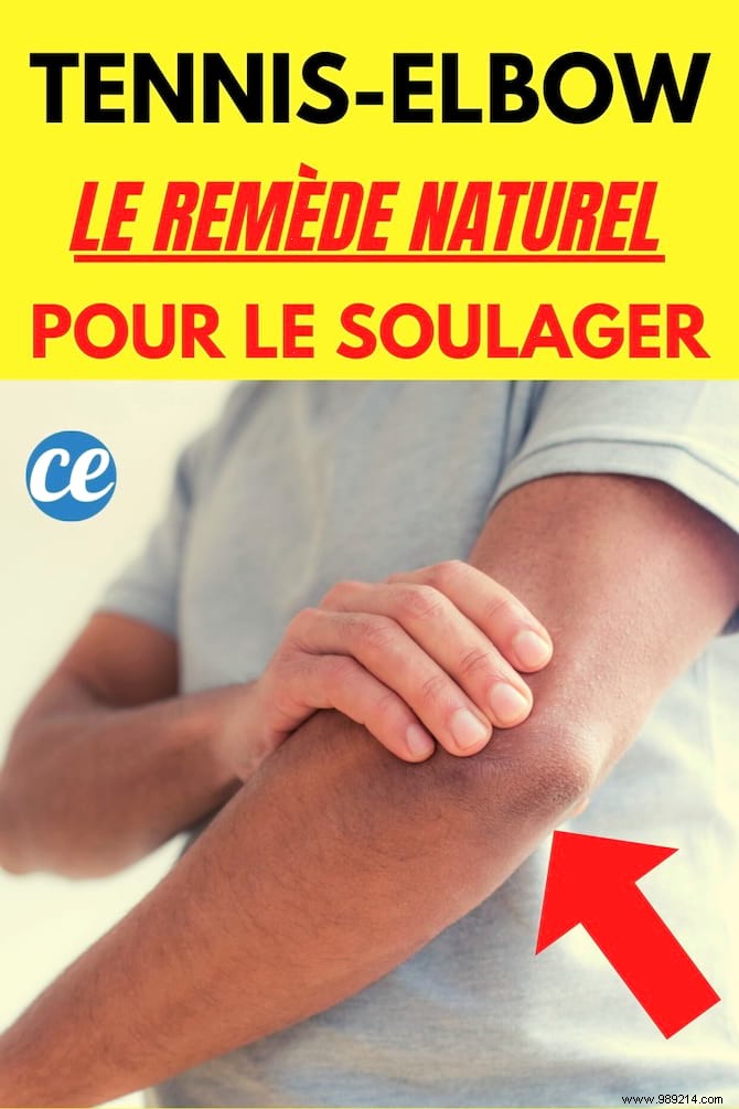 Natural Aloe Vera Remedy for Tennis Elbow: Proven Relief from Elbow Pain