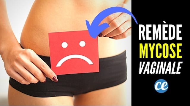 Relieve Vaginal Yeast Infection Quickly with Baking Soda: A Natural Home Remedy