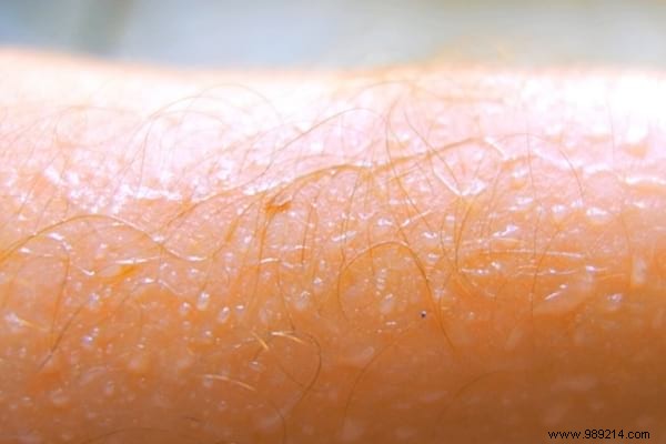 9 Proven Tips to Eliminate Buttocks Pimples for Good