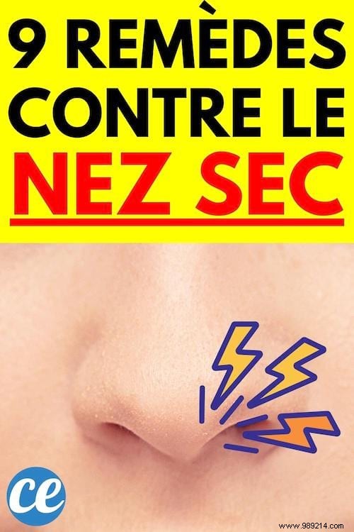 9 Time-Tested Natural Remedies for Dry, Irritated Nose – Pharmacist Approved