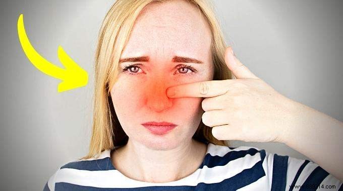 9 Time-Tested Natural Remedies for Dry, Irritated Nose – Pharmacist Approved