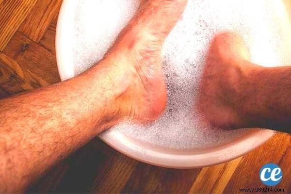8 Proven Home Remedies for Ingrown Toenails: Expert Tips for Fast Relief