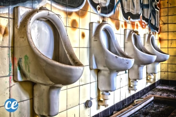 Is It Normal for Men to Pee Sitting Down? Hygiene, Splash Control, and Prostate Benefits