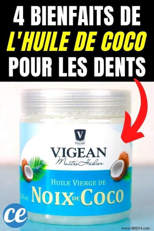 4 Science-Backed Benefits of Coconut Oil for Teeth: The Power of Oil Pulling