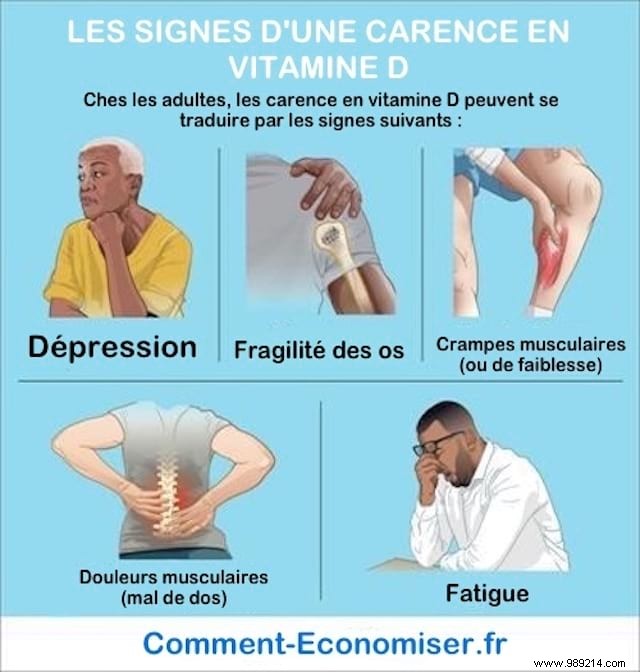 9 Telltale Signs of Vitamin D Deficiency – Backed by Science and Expert Insights