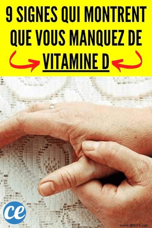 9 Telltale Signs of Vitamin D Deficiency – Backed by Science and Expert Insights