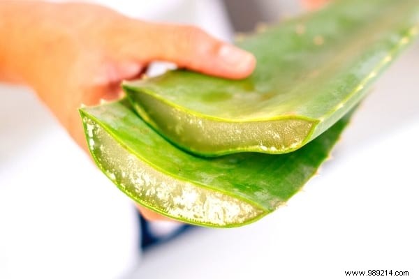 17 Dermatologist-Recommended Natural Remedies for Scalp Psoriasis Relief