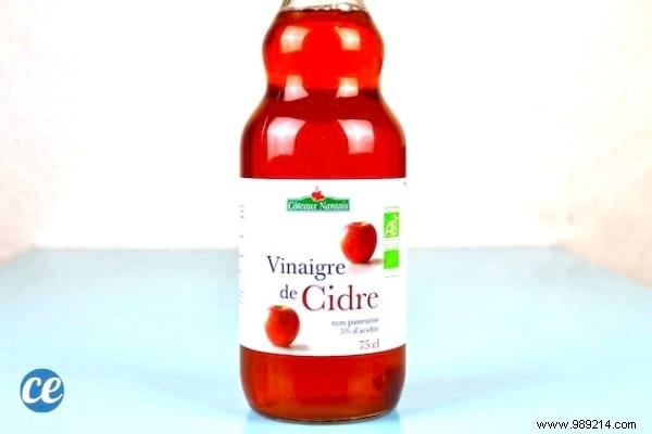 17 Dermatologist-Recommended Natural Remedies for Scalp Psoriasis Relief