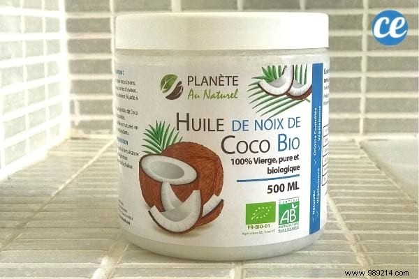 17 Dermatologist-Recommended Natural Remedies for Scalp Psoriasis Relief