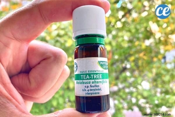 17 Dermatologist-Recommended Natural Remedies for Scalp Psoriasis Relief