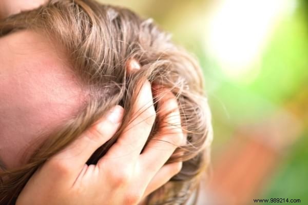 17 Dermatologist-Recommended Natural Remedies for Scalp Psoriasis Relief