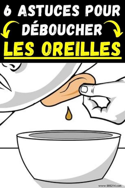 6 Safe, Natural Ways to Unclog Your Ear at Home – Trusted Remedies