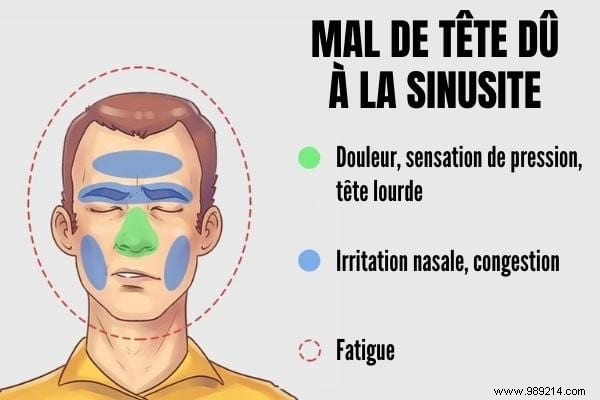 5 Common Types of Headaches: Symptoms, Causes, and Proven Remedies