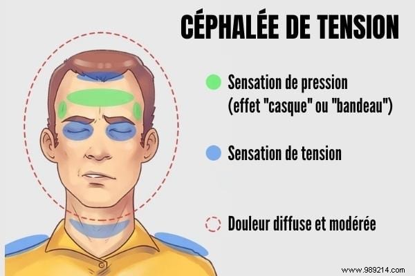 5 Common Types of Headaches: Symptoms, Causes, and Proven Remedies