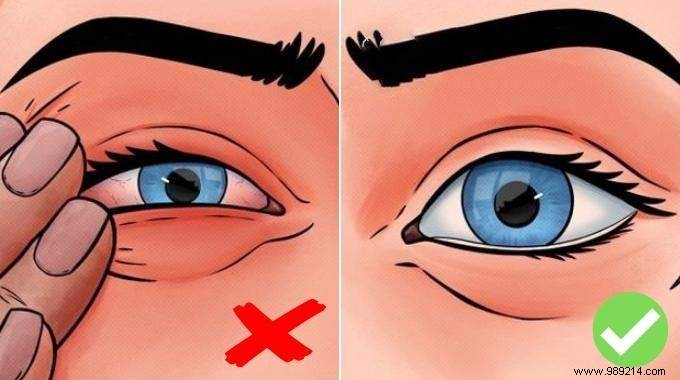 5 Proven Tips from My Optician Sister to Quickly Remove Dust from Your Eye