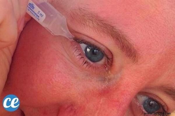 5 Proven Tips from My Optician Sister to Quickly Remove Dust from Your Eye