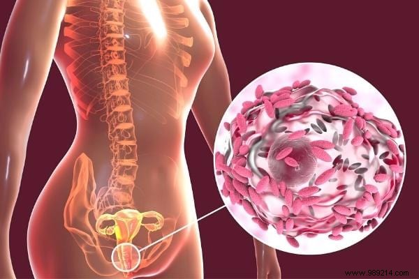 12 Expert-Backed Natural Remedies to Eliminate Vaginal Odor