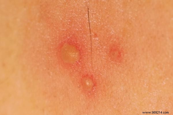 12 Expert-Backed Natural Remedies to Eliminate Vaginal Odor