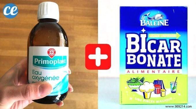 Baking Soda and Hydrogen Peroxide: A Dentist-Recommended Remedy for Fast Gingivitis Relief