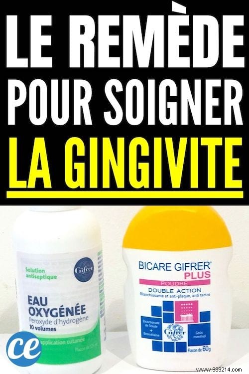 Baking Soda and Hydrogen Peroxide: A Dentist-Recommended Remedy for Fast Gingivitis Relief
