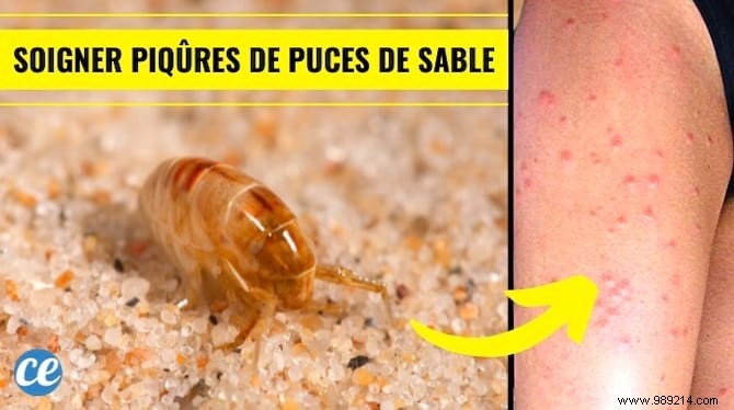 Instant Relief for Sand Flea Bites: Proven Baking Soda Remedy