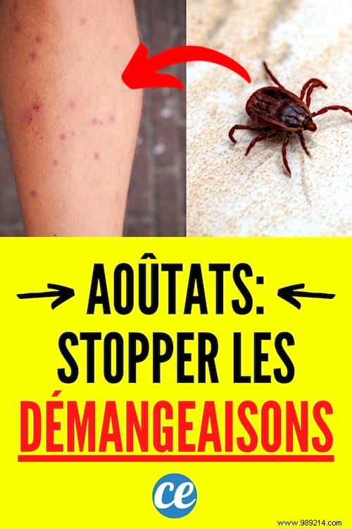 5 Time-Tested Grandmother s Remedies to Relieve Chigger Bite Itching